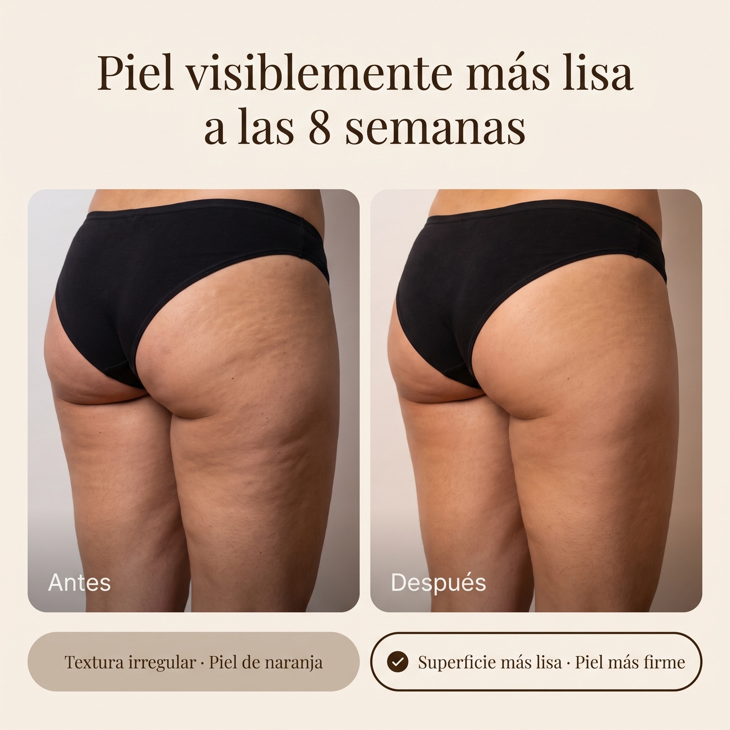 Orelis Aceite Anticelulítico